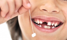 Пять мифов о молочных зубах